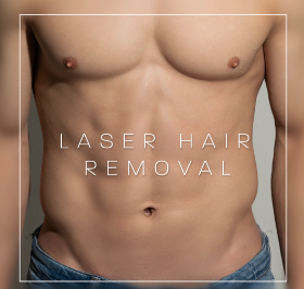 Laser hair removal with the Candela GentleMax Pro Plus at No Filter Medical Spa in Brickell, Miami