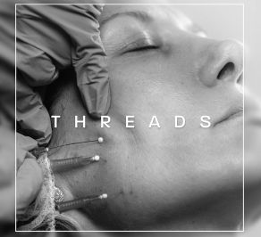 PDO thread lift treatment at No Filter Medical Spa in Brickell, Miami